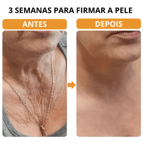 Botox Firmador e Redutor de Rugas - Bee Venom