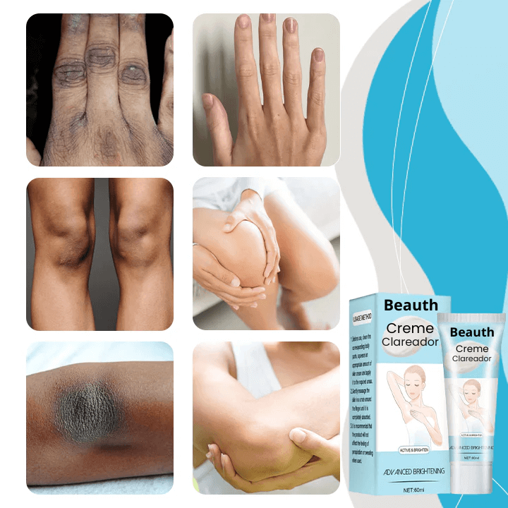 Creme Beauth - Clareador De Manchas Na Pele