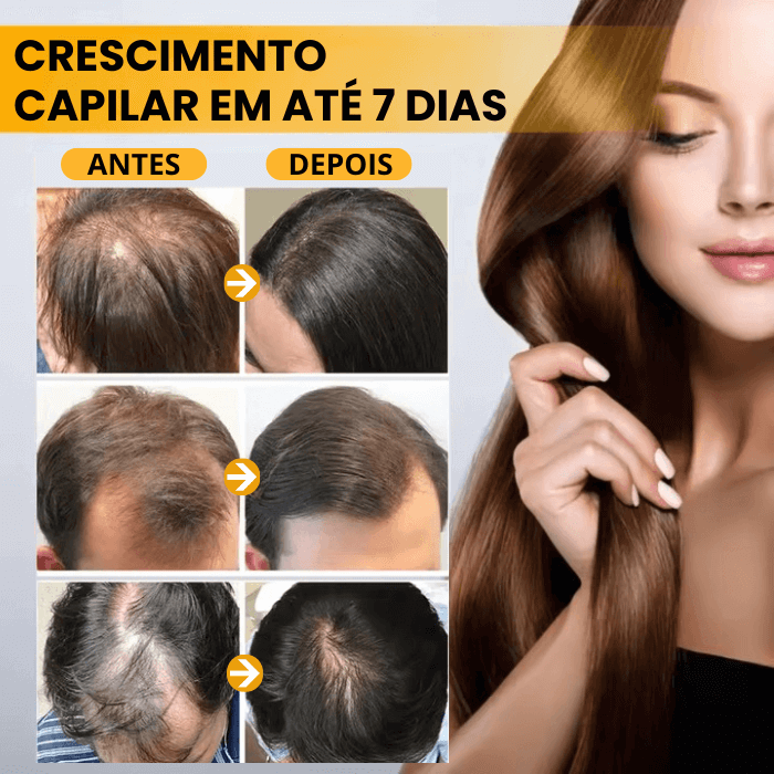 Sérum Para Crescimento Capilar - Biotin™ 7 Dias