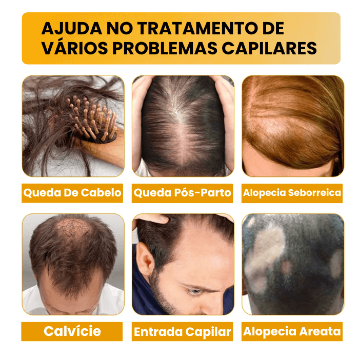 Sérum Para Crescimento Capilar - Biotin™ 7 Dias